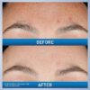 CeraVe Retinol Serum for Post-Acne Marks and Skin Texture | Pore Refining, Resurfacing, Brightening Facial Serum with Retinol and Niacinamide | Fragrance Free, Paraben Free & Non-Comedogenic| 1 Oz - Image 5
